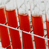 身近にいるのに知らない！「光合成細菌」というスーパー微生物